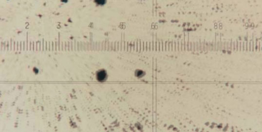 Mikroskopische Partikelanalyse von Hydrauliköl mit hoher Verschmutzung nach ISO Klasse 22/20/17